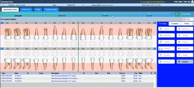 Creating elaborated teeth chart for patients with Denticon